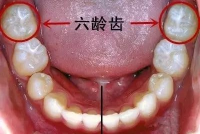 这是恒牙列最早萌出的牙齿,也是口腔中发育,萌出最早,行使功能最长的